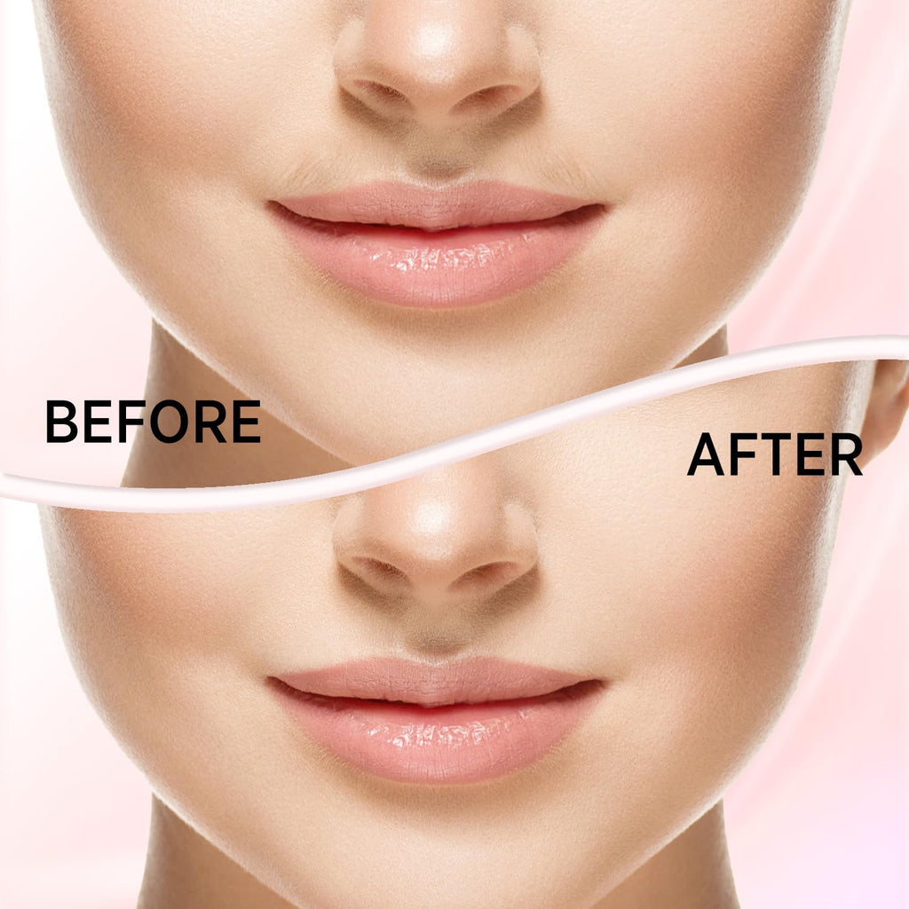 Facial Hair Removal for Women U238